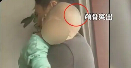 湖南“大頭娃娃”事件 湖南“大頭娃娃”事件